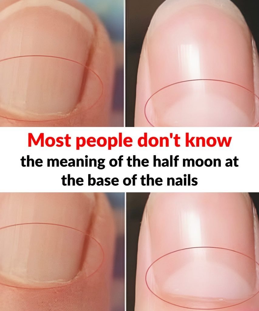 What does the half moon at the base of the nails mean? 25 571818120 853742097091583 4218506580478427062 n