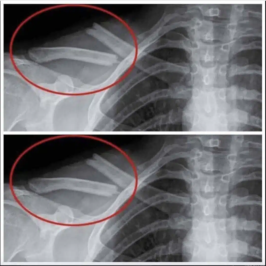 The 8 unexpected transformations in your body when you give up diet sodas 25 8 choses qui arrivent a votre corps lorsque vous arretez de boire du soda light 1.jpg