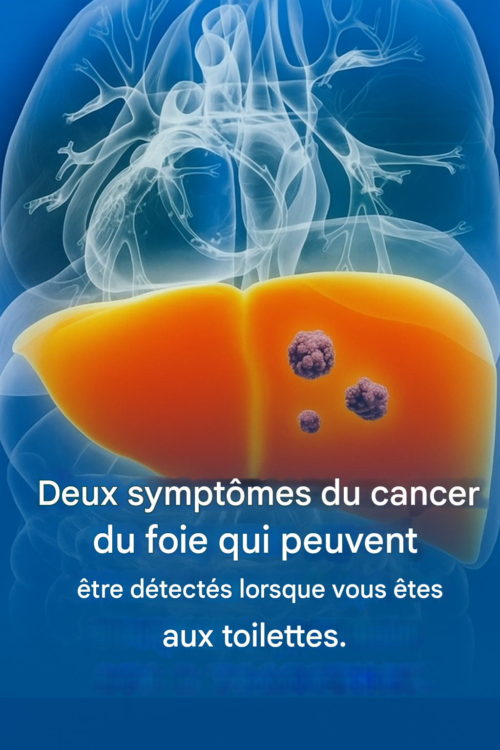 Deux signes de cancer du foie qui peuvent être remarqués dans la salle de bain 25 translated image 26 4
