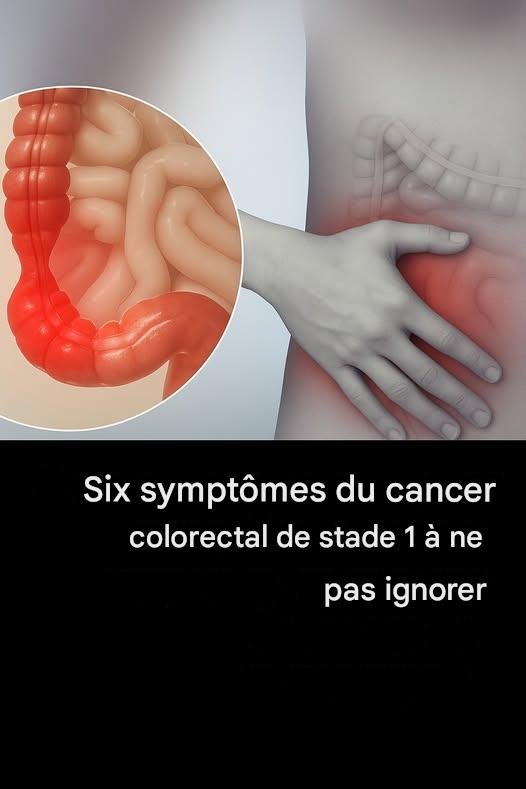 6 symptômes du cancer colorectal de stade 1 à ne pas ignorer 25 f061fe42 d4cb 4396 9cf1 cc52fb9e2232