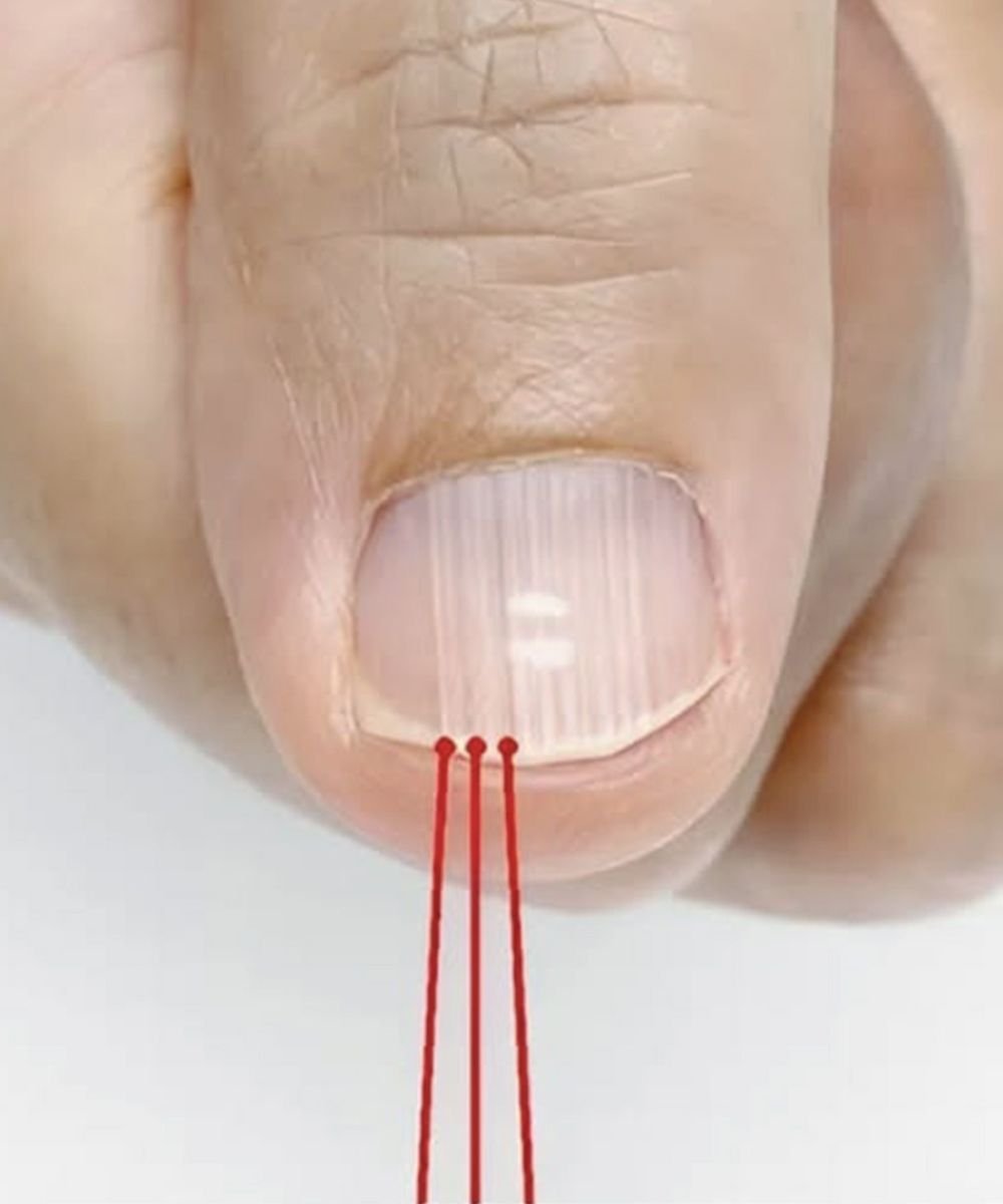 If you have these lines on your nails after 40, it is a clear sign that.. 25 1000x1200 2025 06 23T152838.846