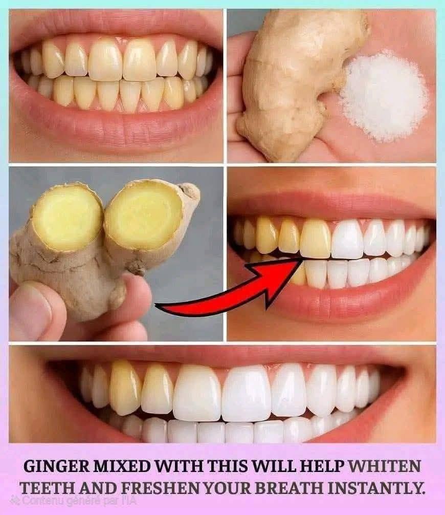 Ginger and salt recipe to whiten teeth and freshen breath naturally 25 601479104 122204055776567604 2625989724186742963 n
