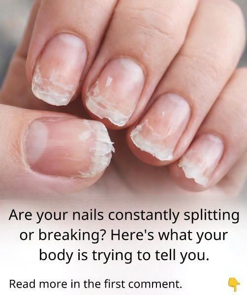 Fragile or brittle nails: what your body is trying to tell you 25 IMG 20260125 WA0003