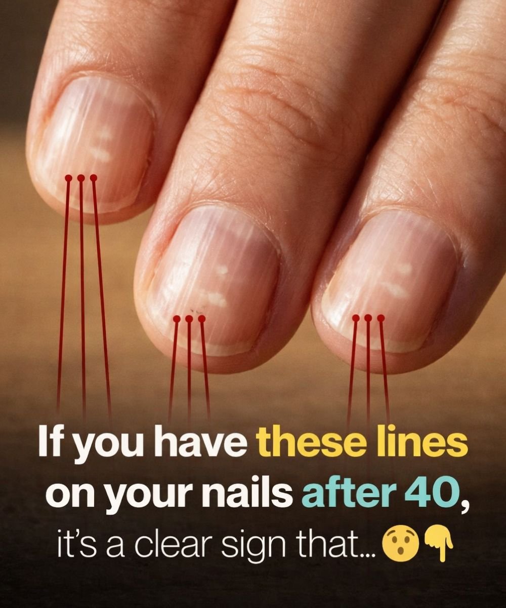 Foods That Support Stronger Nails After 40 25 anh post 2026 01 12T135801.862