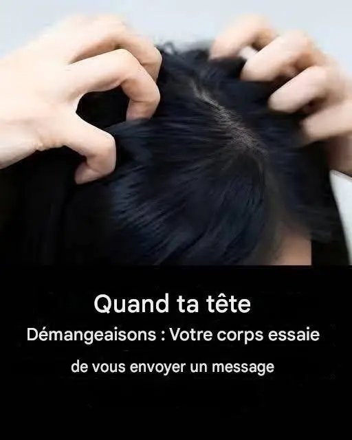# Votre tête vous démange ? Voici les principales raisons. 25 1781880626414