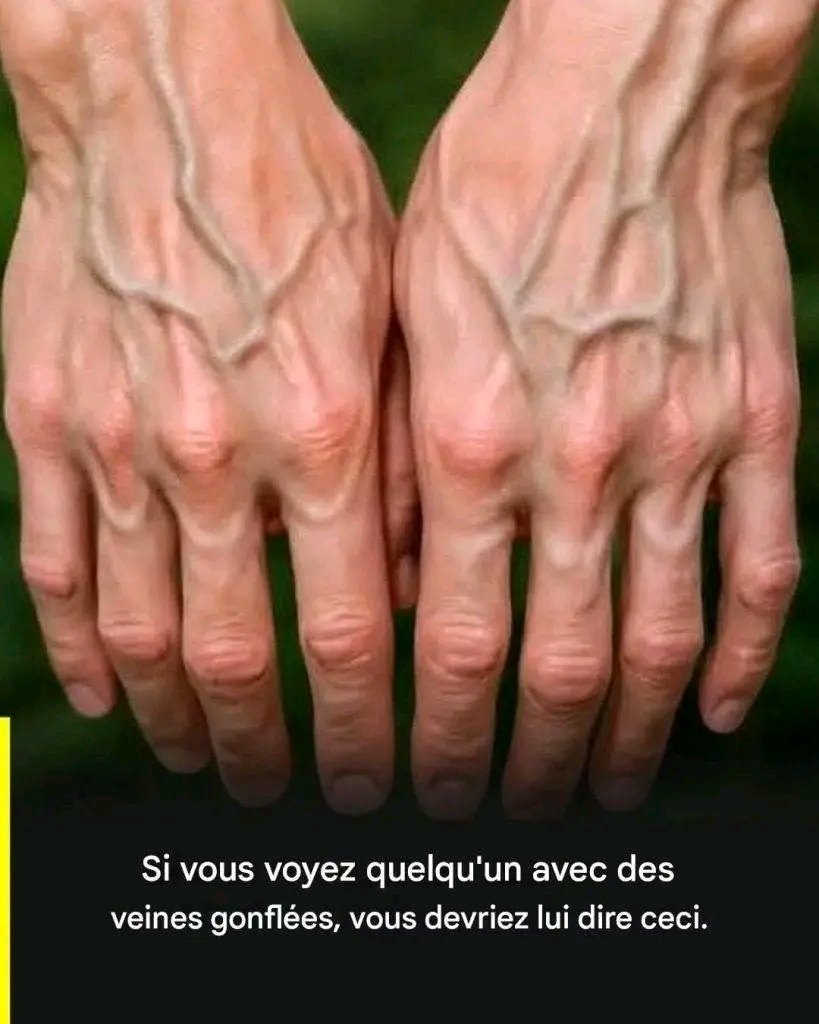 Si vos veines sont visibles, cela signifie que vous êtes… Voir plus 25 1781892413908