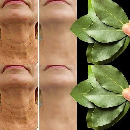 La feuille de laurier est-elle 100 000 fois plus puissante que le Botox ? | Un effaceur de rides naturel, même à 70 ans ! 25 image 1