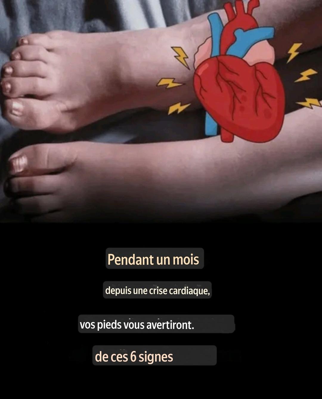 # Un mois avant une crise cardiaque, vos pieds vous alertent de ces six signes. 25 translation 20260701 184015